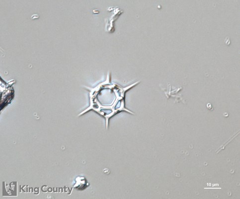 Photo of Dictyocha speculum